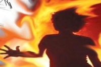 Up boy set ablaze for saving his sister from molesters