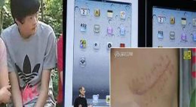 Chinese Teenager Sells Kidney For iPhone