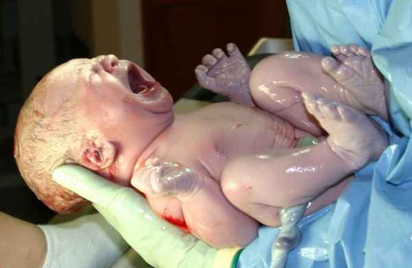 special day newborn delivery in visakhapatnam