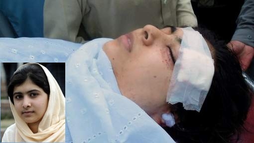 Malala Yousafzai: Bullet removed by Pakistan doctors