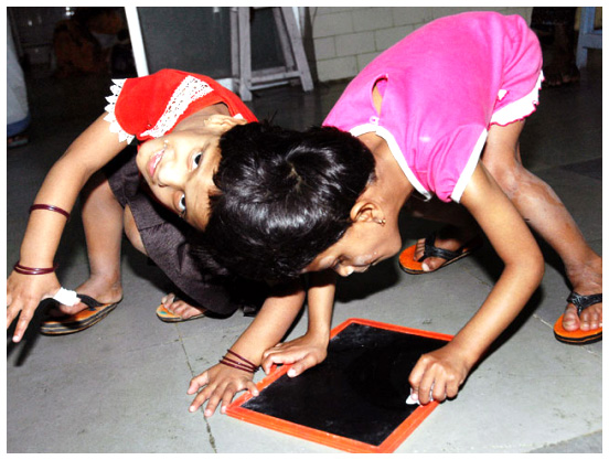 Children's Hospital, the lives of Veena and Vani