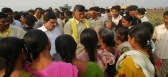 Chandrababu naidu knee pains in pada yatra