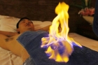 Fire therapy to treat illness in china pics