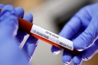Coronavirus test positivity rate in telangana plunges