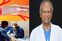 Aig uses new technique for irregular heart rhythm disorder