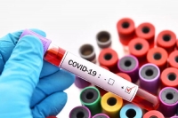 Ap records 80 new covid 19 cases in the last 24 hours taking the overall tally to 1 177