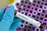 Coronavirus suspect skip quarantine was held in hyderabad while travelling by bus