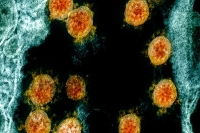 Covid 19 is evolving getting better at becoming an airborne virus