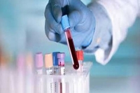 Coronavirus positive cases tally reaches 534 in andhra pradesh