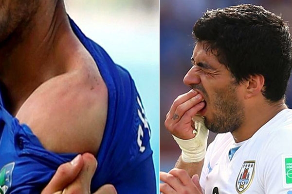 Uruguay football player luis suarez bites italy defendar player