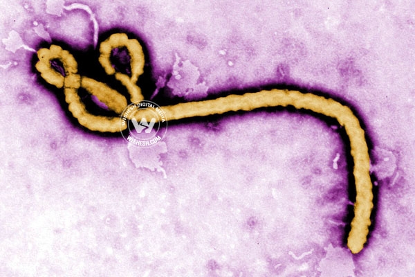 Nigeria returned hyderabad person in gandhi hospital with ebola symptoms